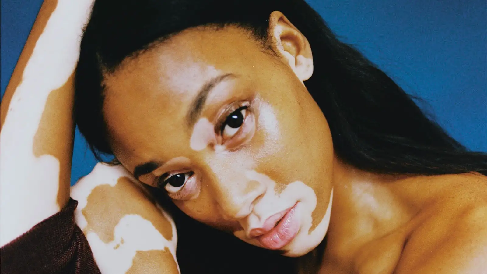 Carrots: Nature's Gift to Vision?